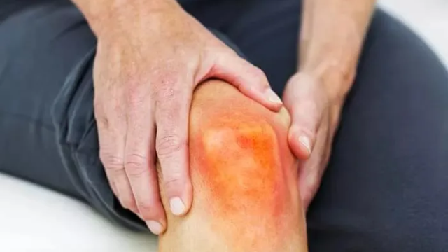 Daftar Makanan Penyebab Asam Urat Tinggi yang Harus Dibatasi Mulai Sekarang!